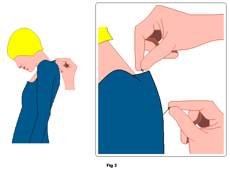 Pinch the excess fabric at the back and mark the tuck with pins.